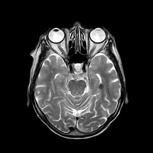 Mit takar az MRI, CT, EEG vagy épp a PET-CT kifejezés?